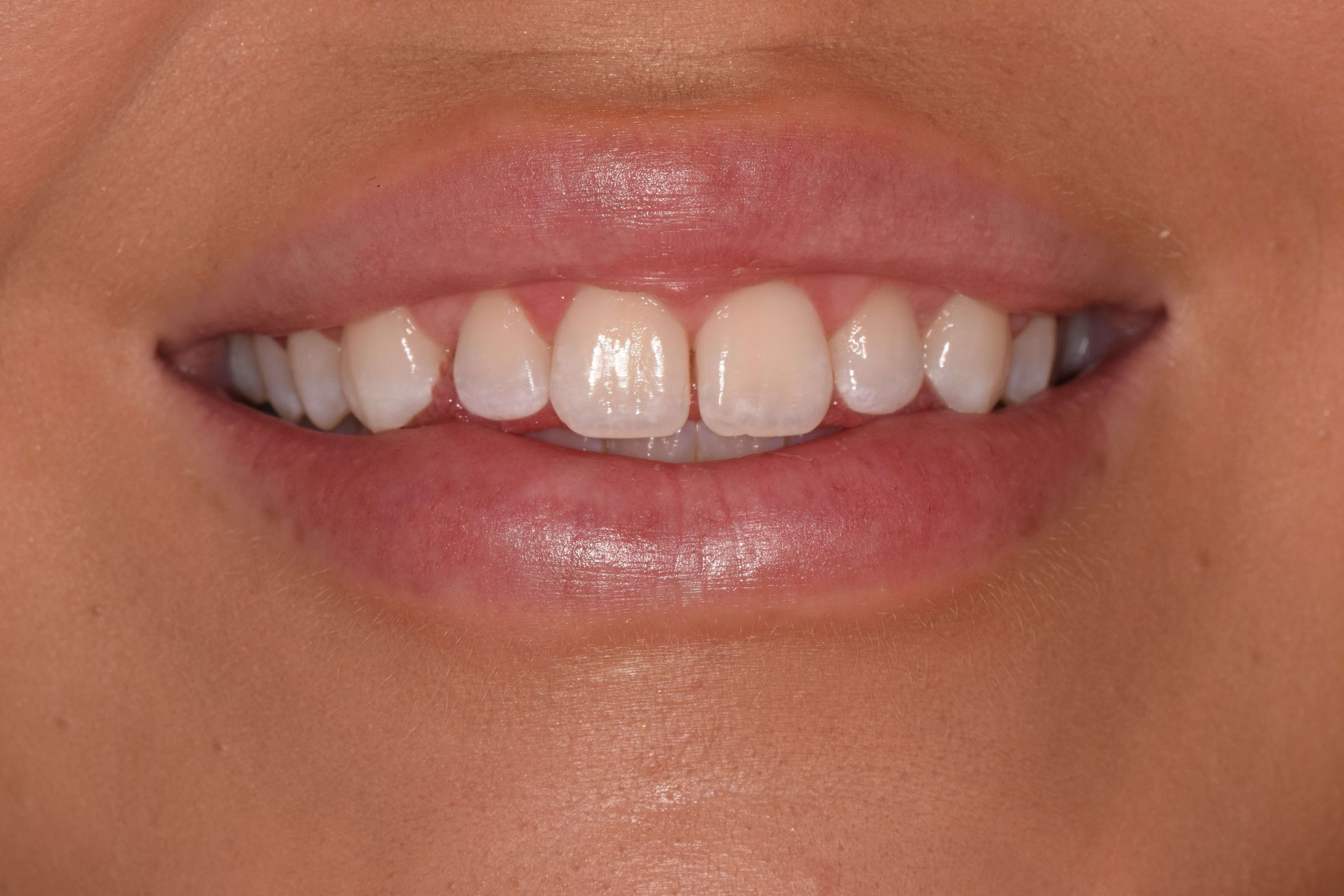 Before Image