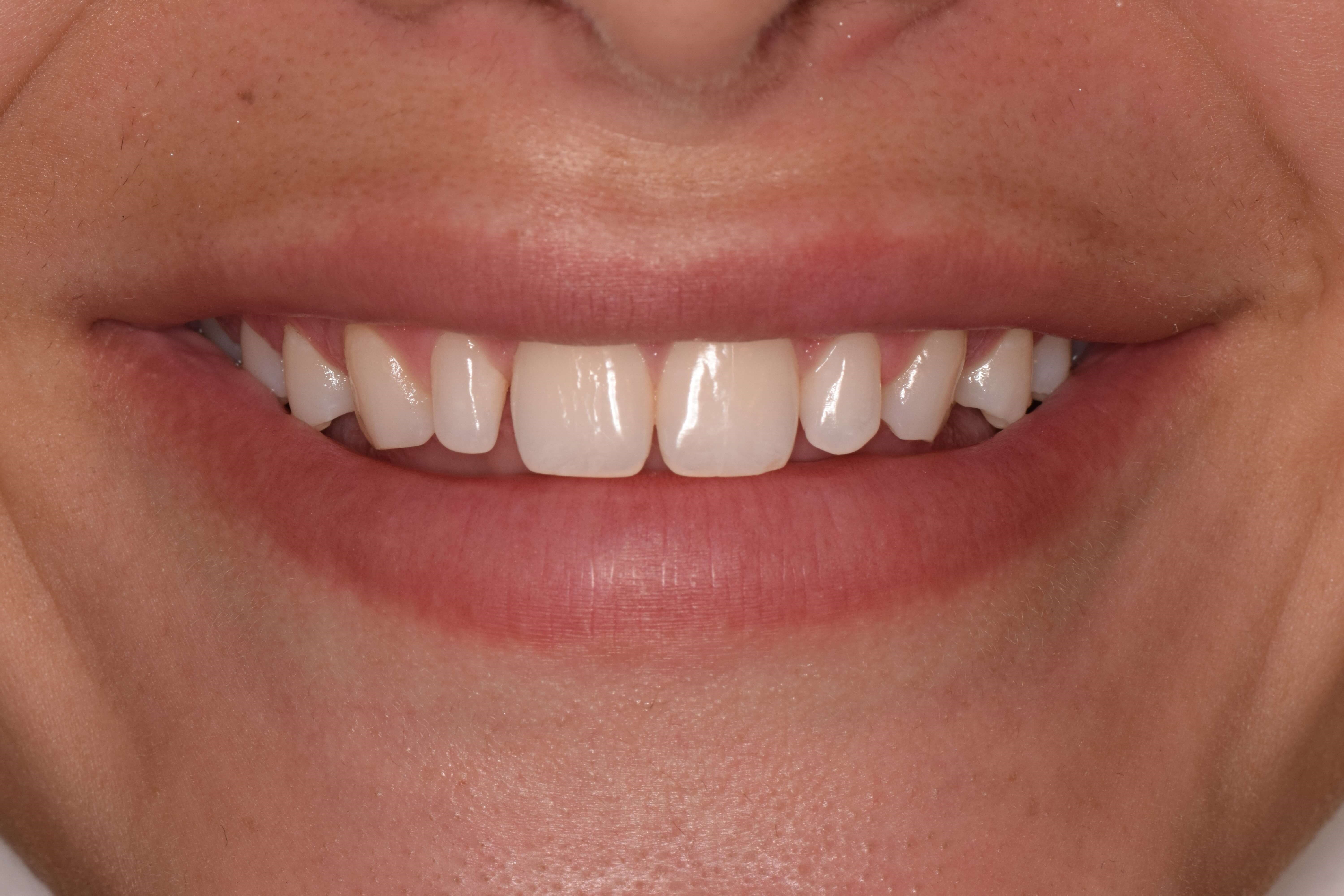 Before Image