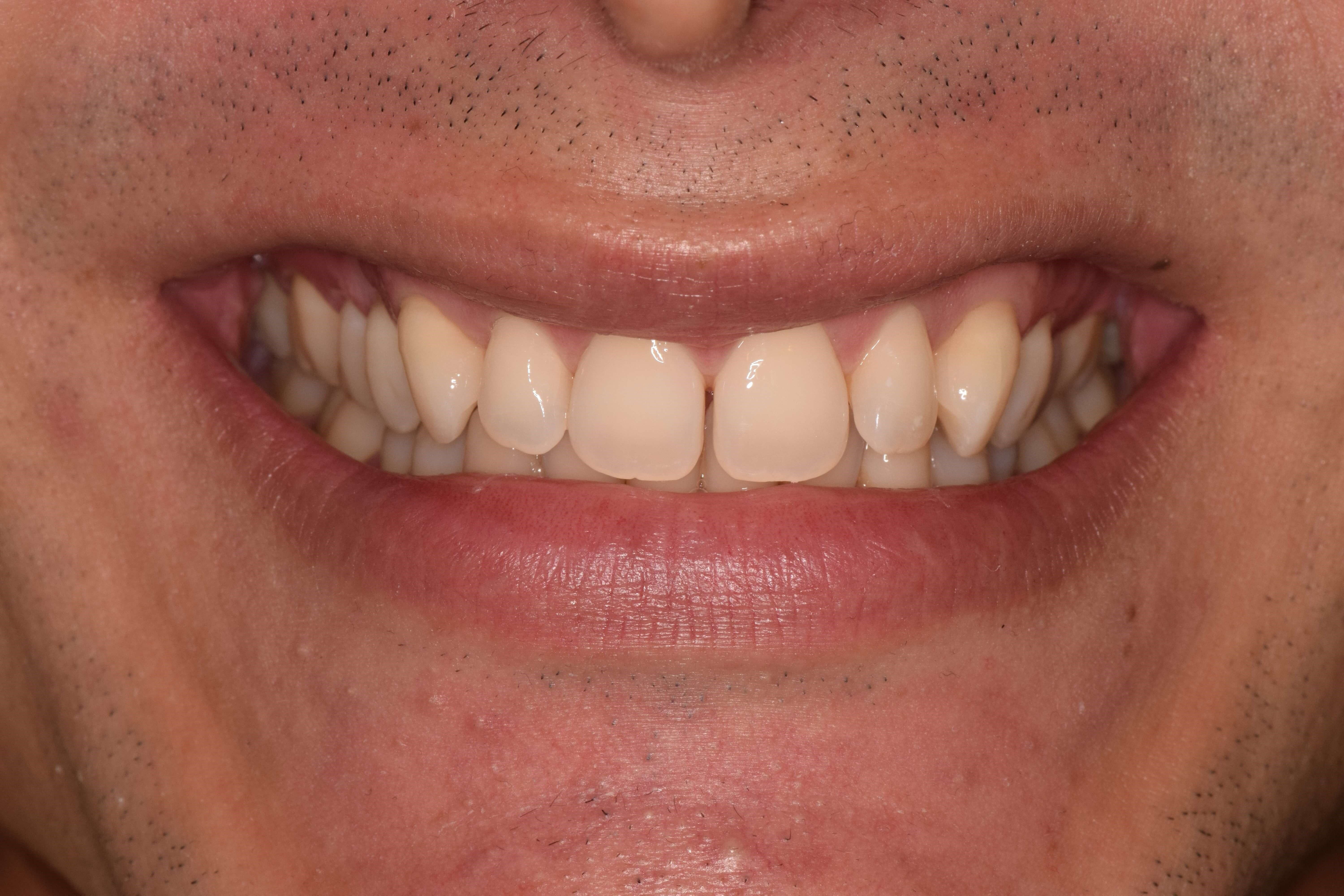 Before Image