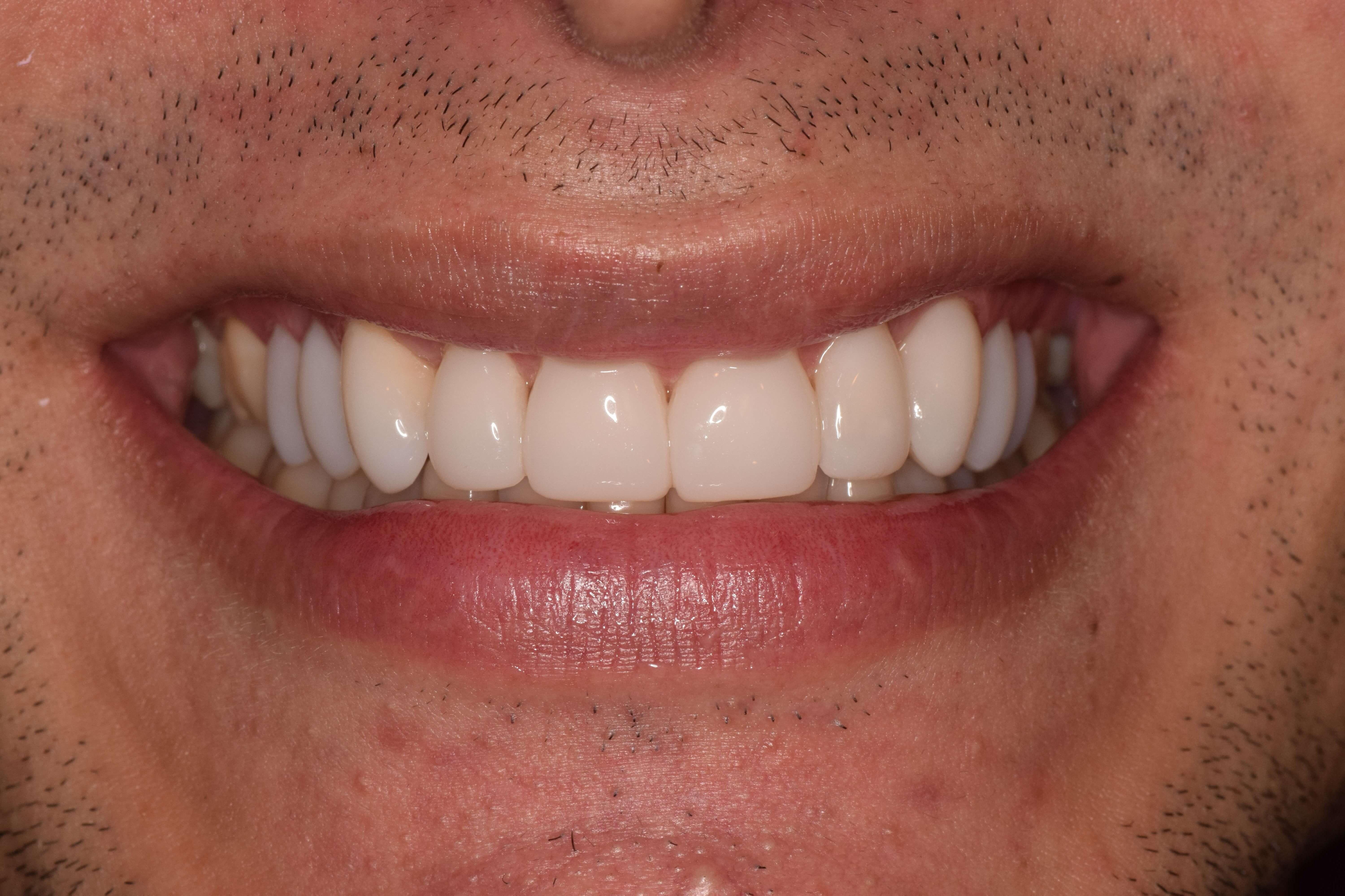 After Image