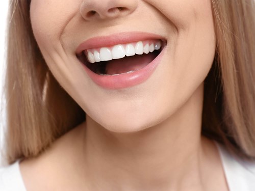 Straighten Crowded Teeth