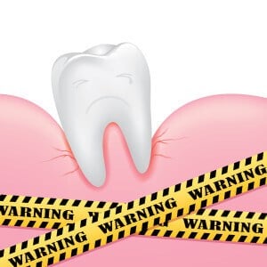 Loose Tooth Here S What To Do Loose Tooth Here S What To Do