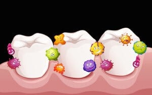 How To Avoid Gum Disease