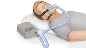 CPAP MAchine