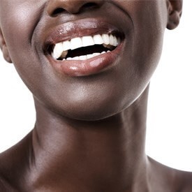 General Dentistry Services In Memphis Tn Memphis Austin Peay