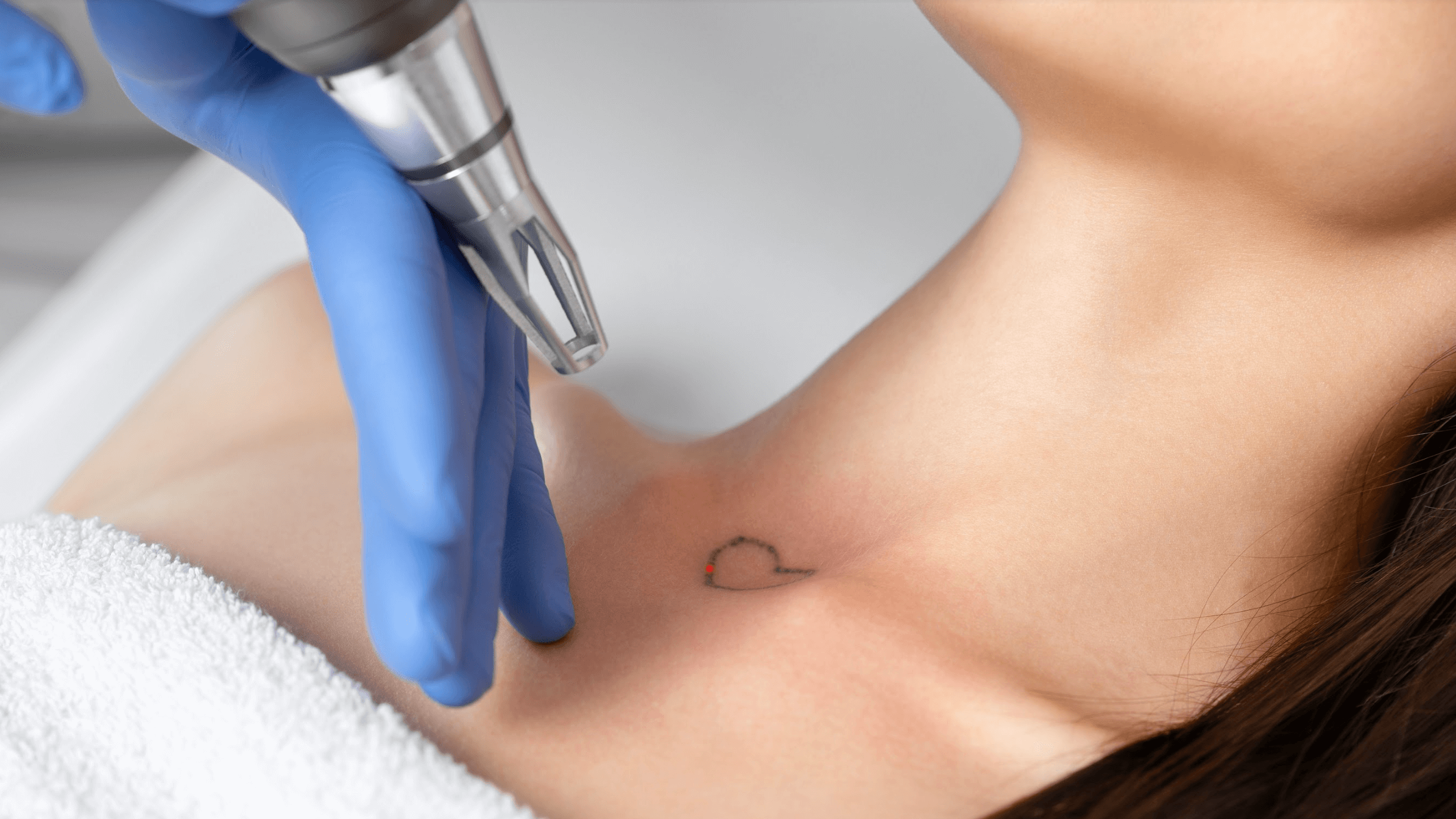 How Painful Is Laser Tattoo Removal?