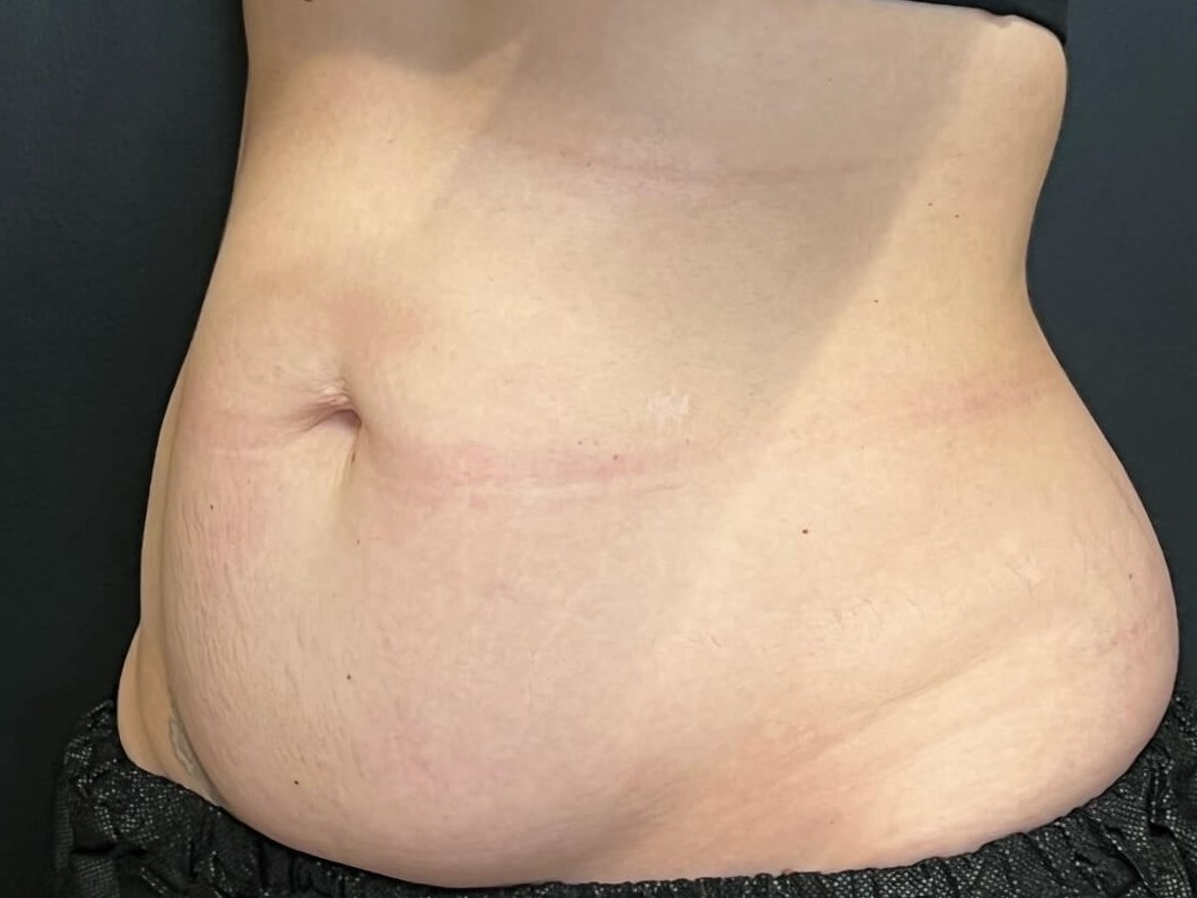Before Image