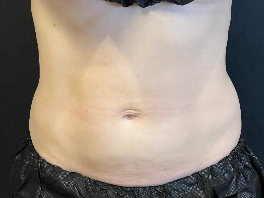 Before Image