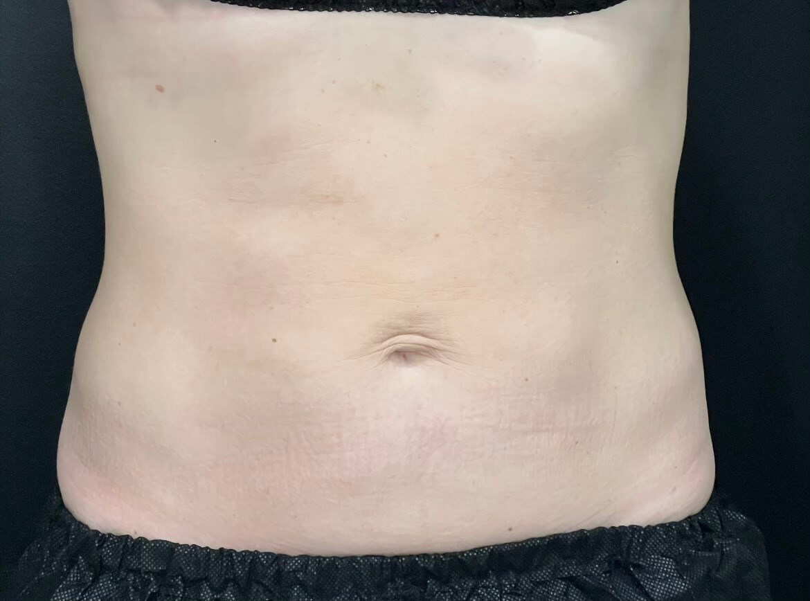 After Image