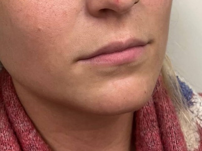 Before Image