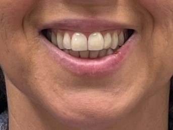 Before Image