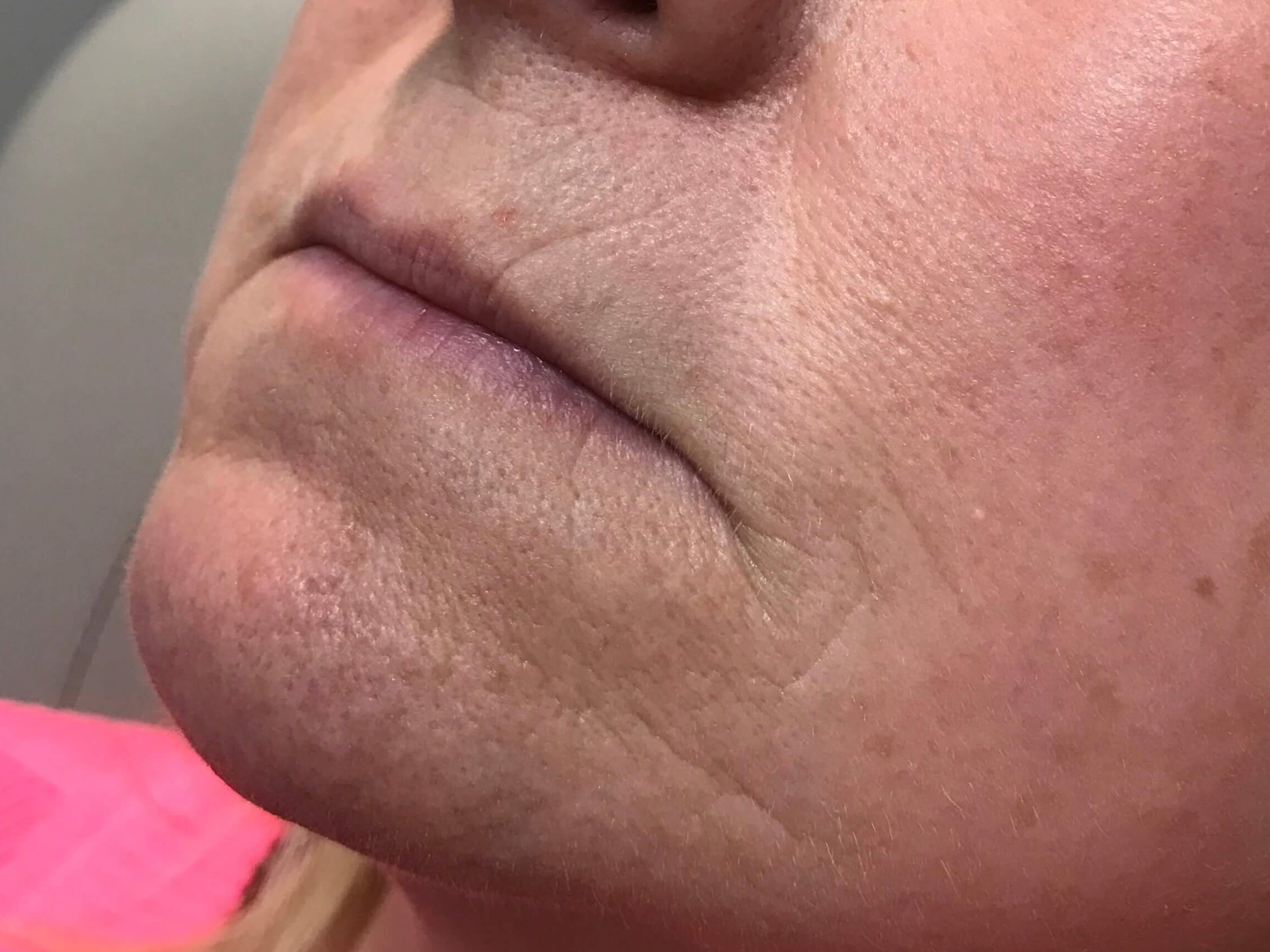 Before Image