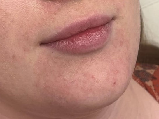 Before Image