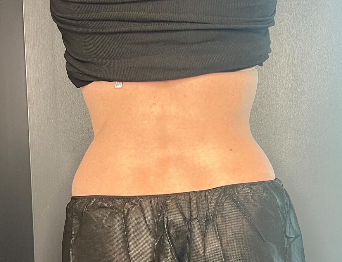 After Image