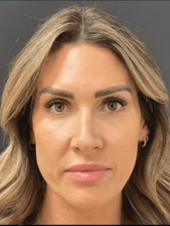 Comprehensive Facial Plan After