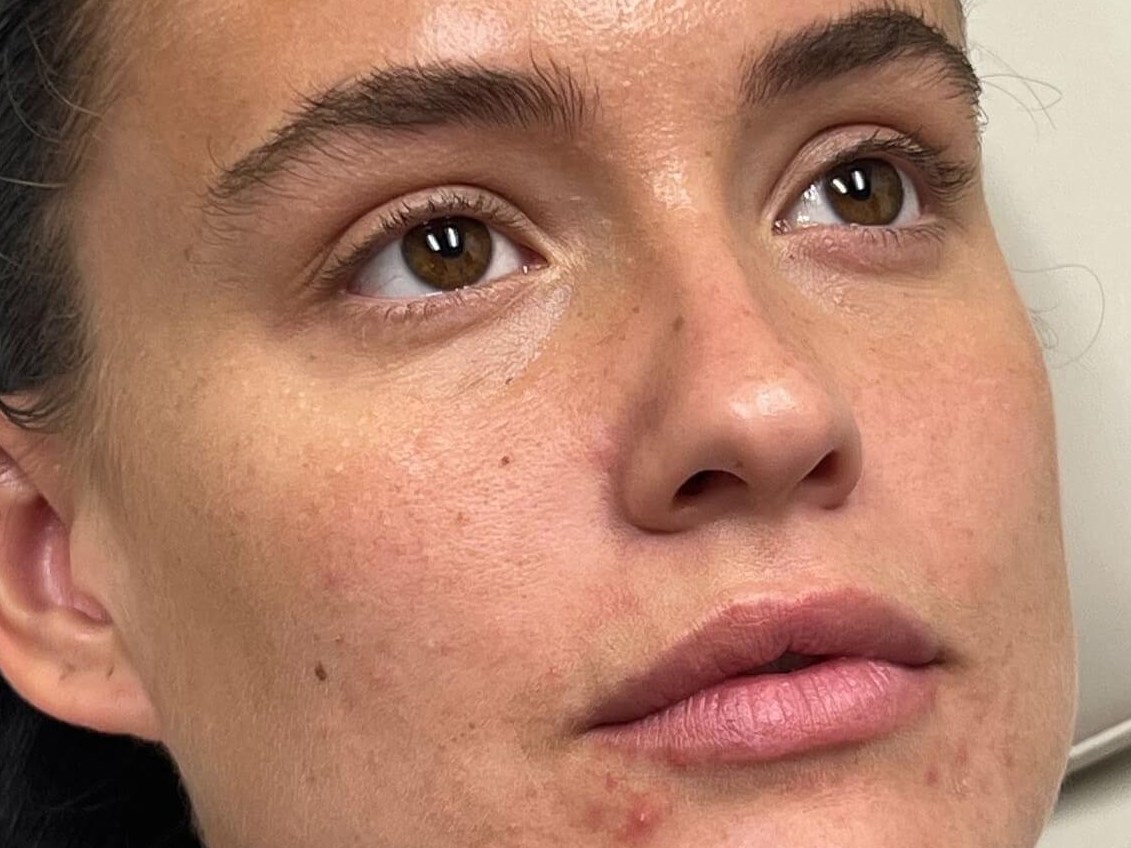 Enhance Your Lips Before