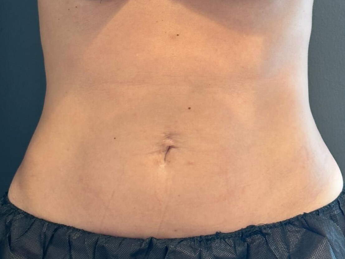 Before Image