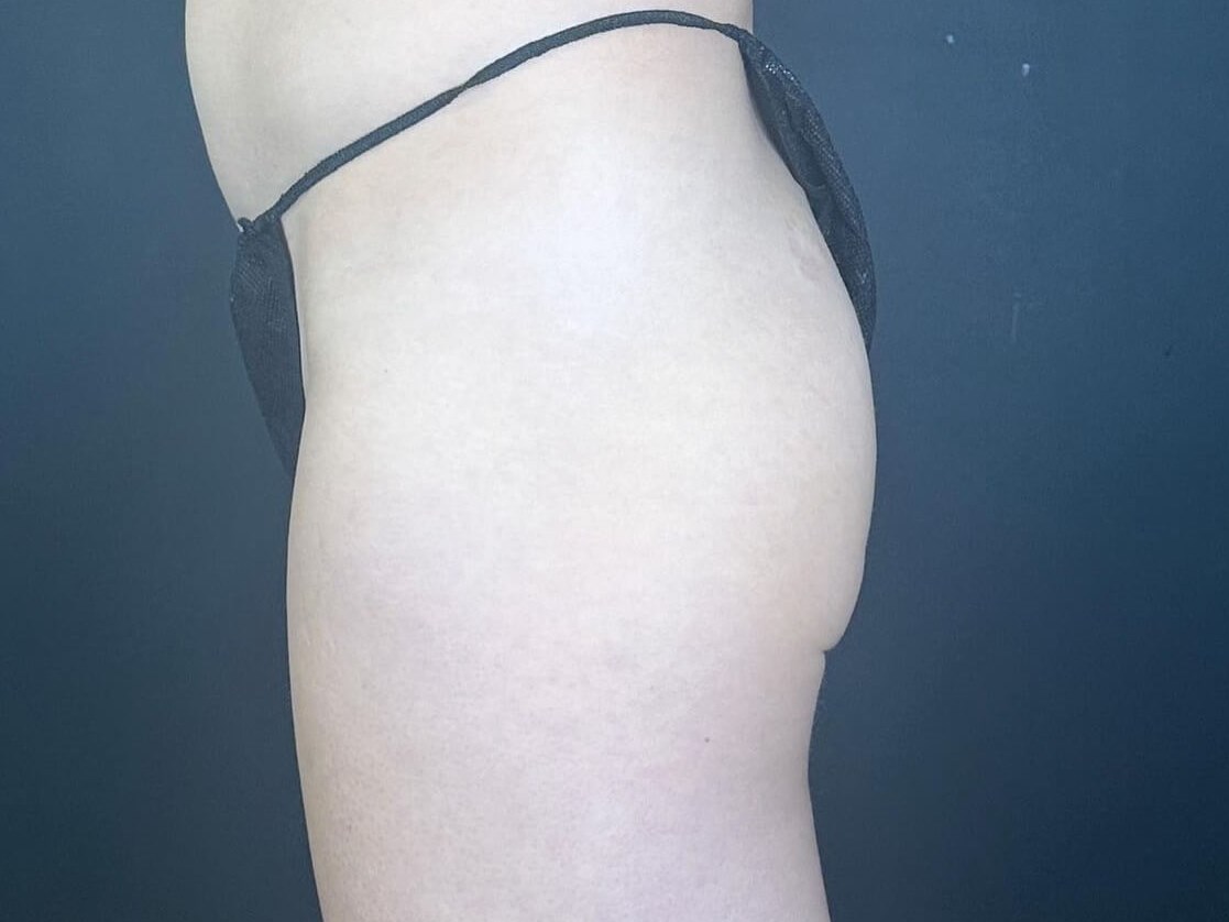 Before Image