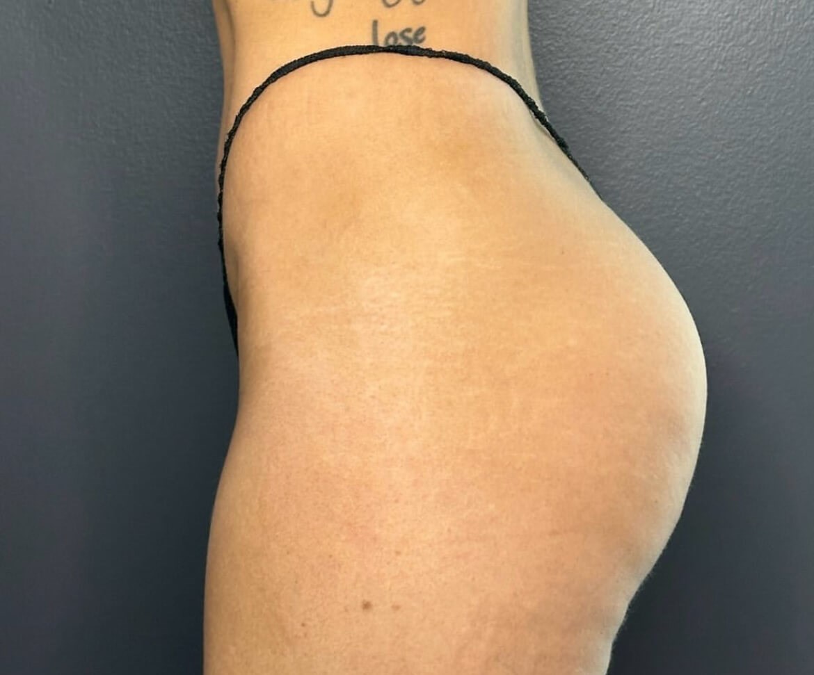 Sculpt Your Buttocks After