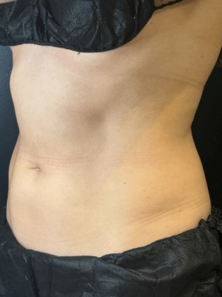 Flatten & Contour Your Stomach After