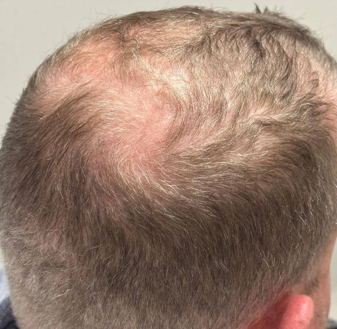 Before Image