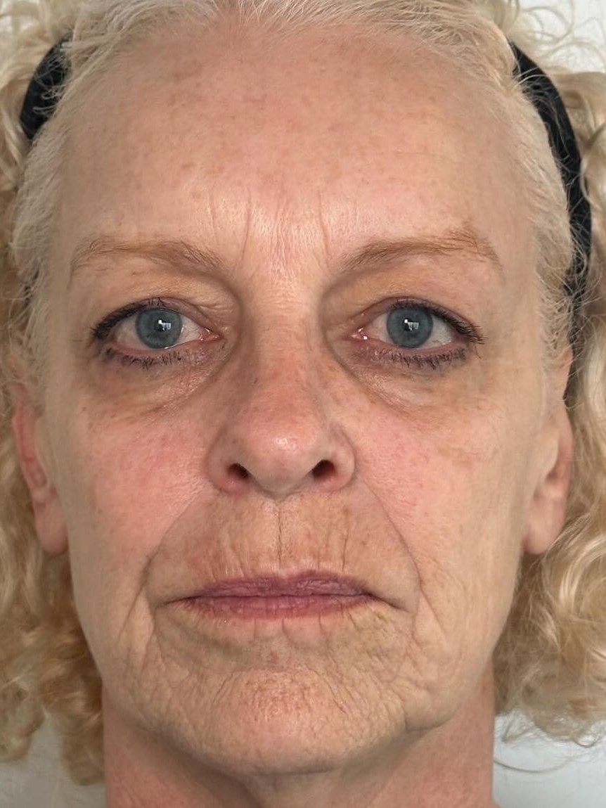 Radiant Skin After
