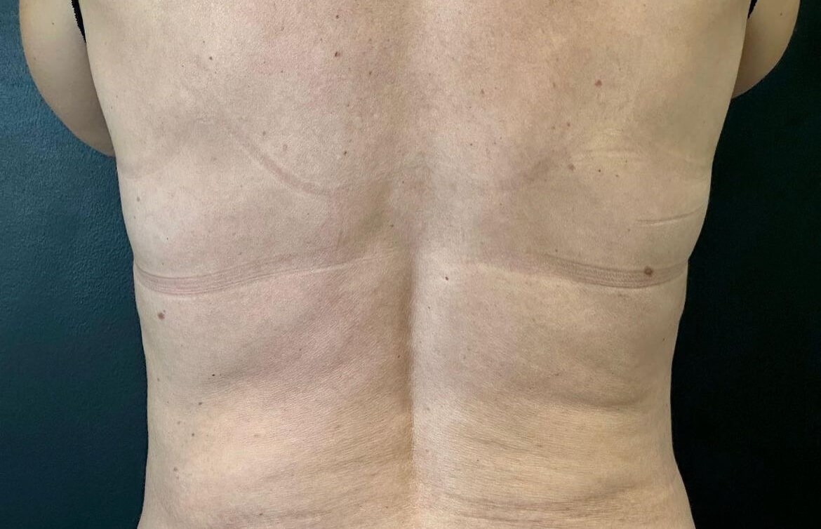Before Image
