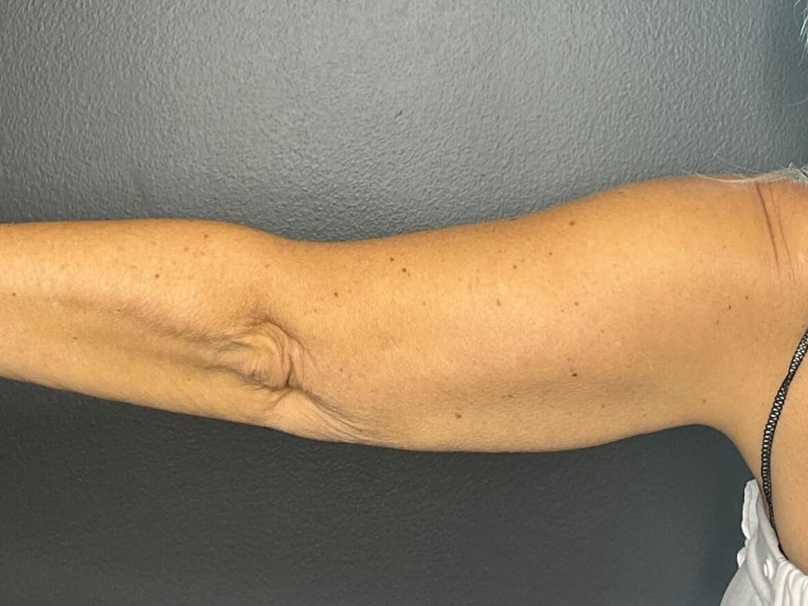 Achieve Sleek Arms After