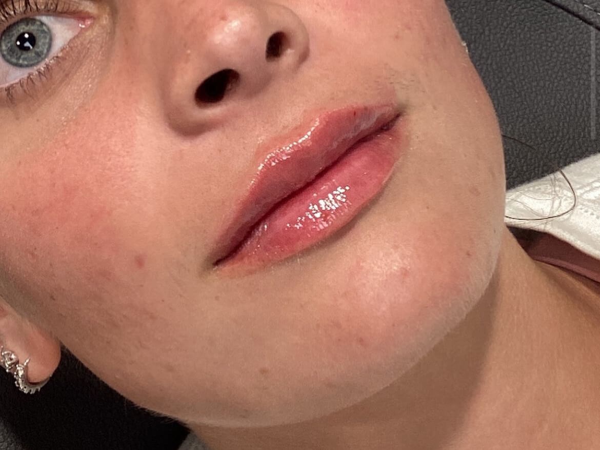 Perfect your Pout After