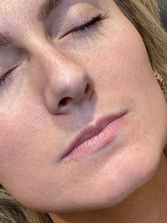 Enhance Your Lips Before