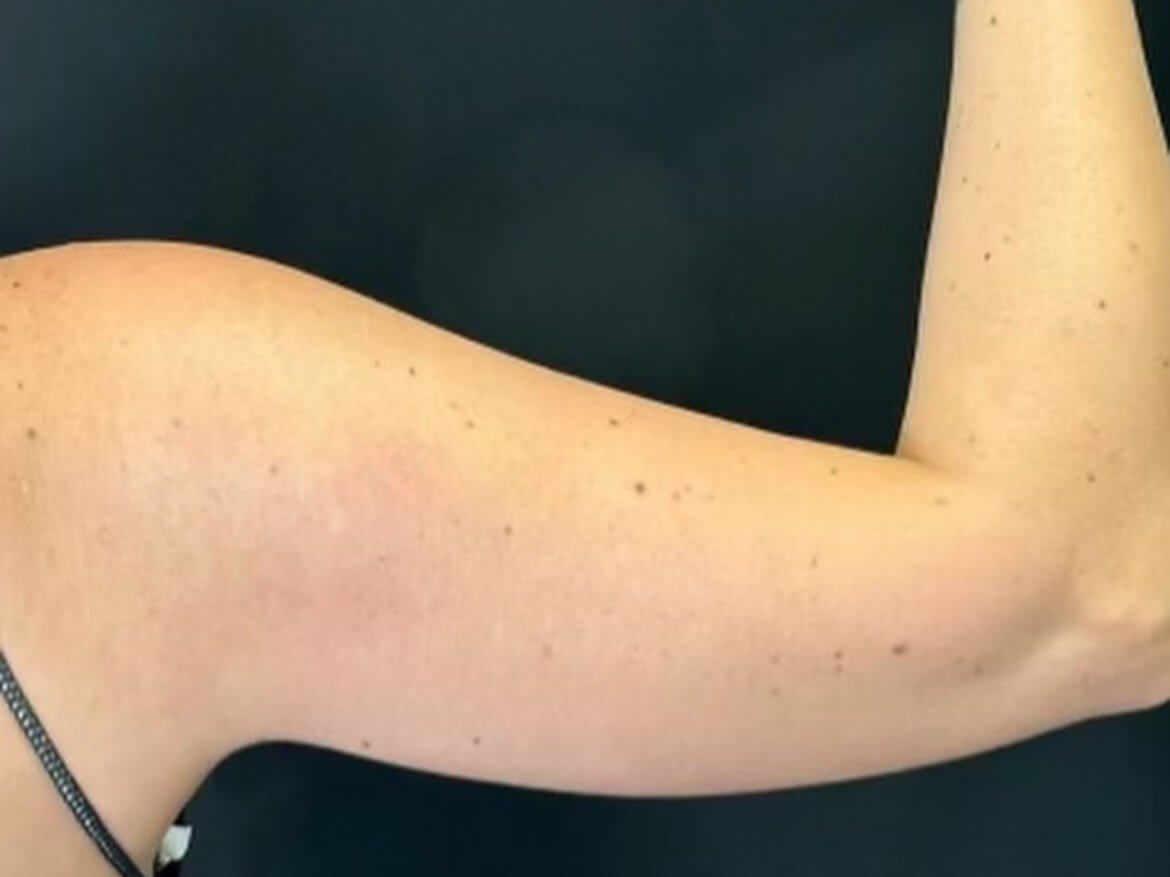 Sculpt your arms at Jem Before