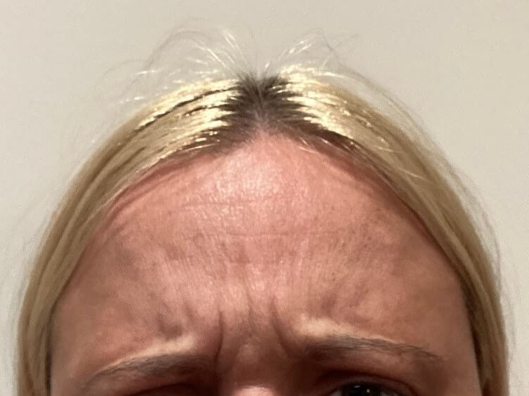 Before Image