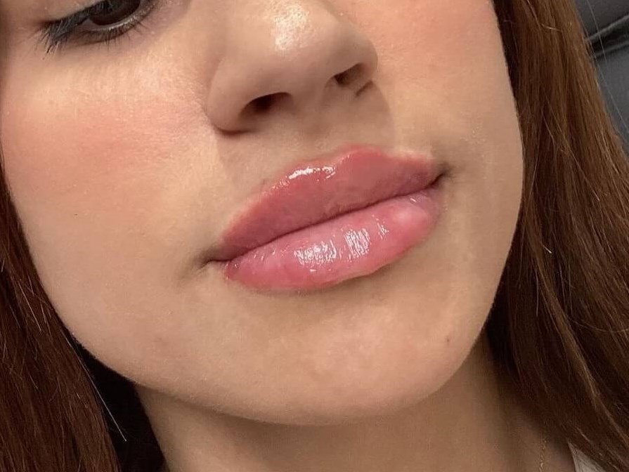 Achieve Beautiful Lips After