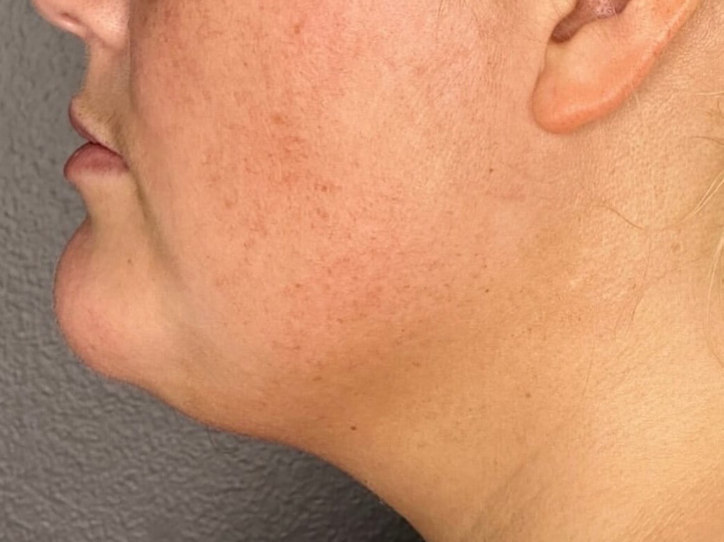 Contour Your Jawline After