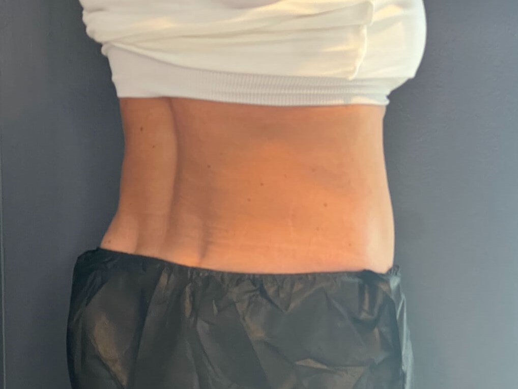 Enhance Your Silhouette After