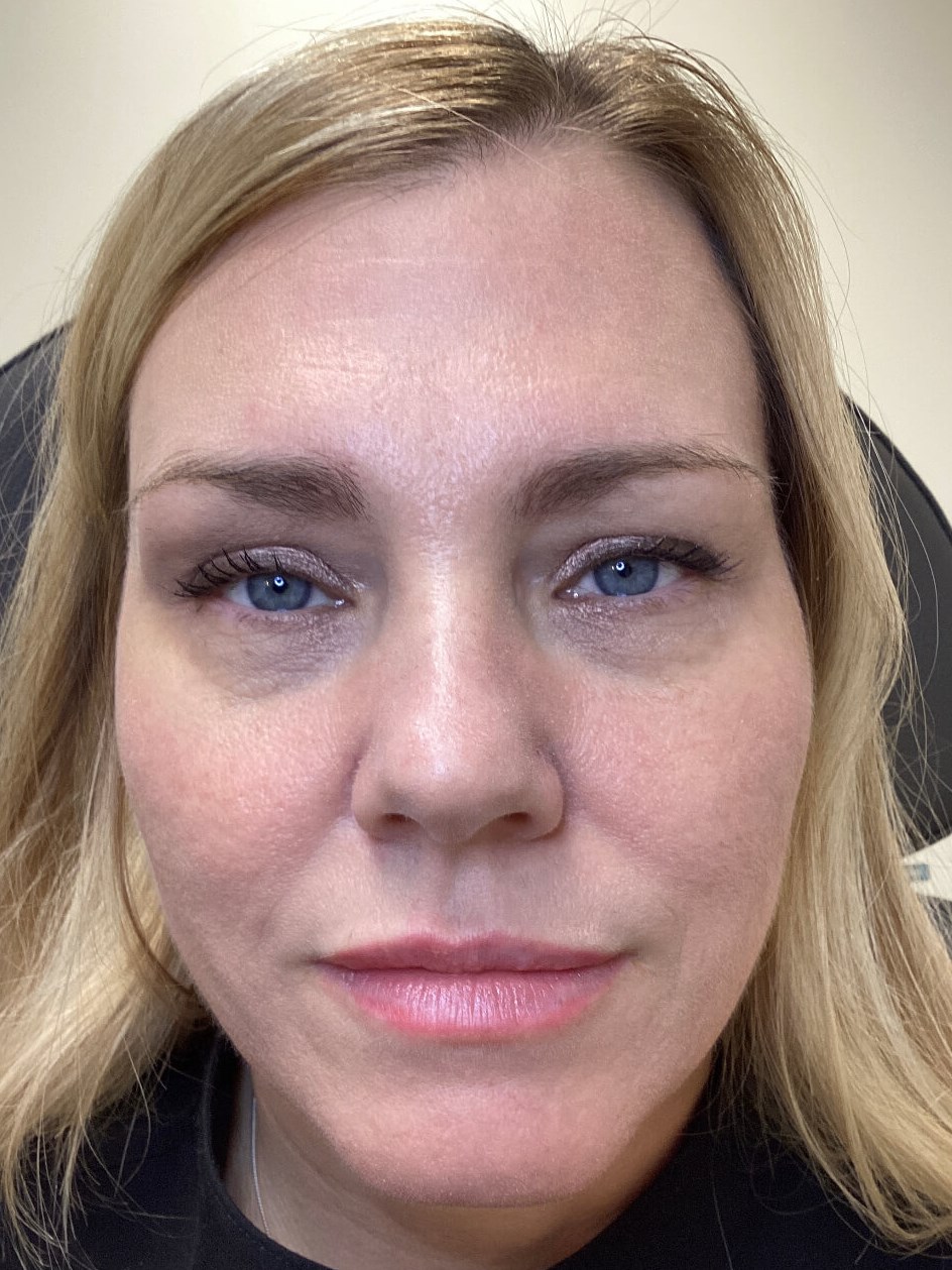 Enhance your natural glow Before