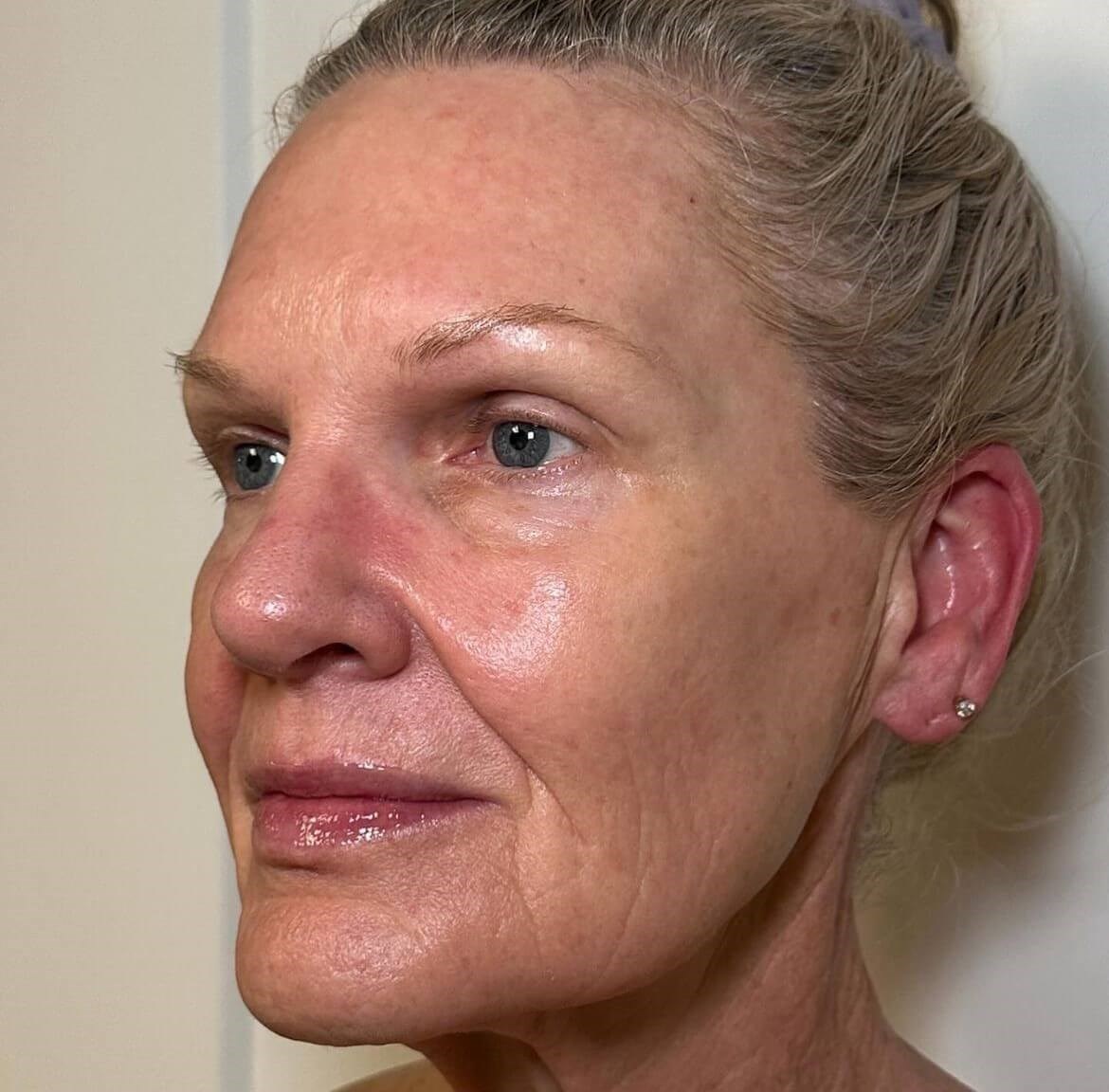 Revitalize your Skin After