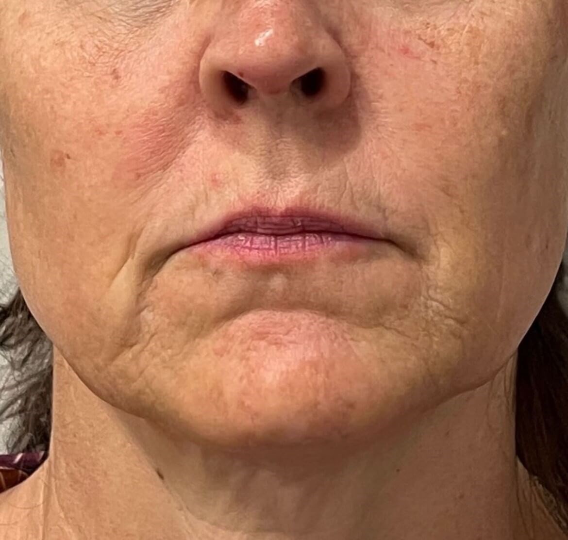 Comprehensive Skin Plan Before