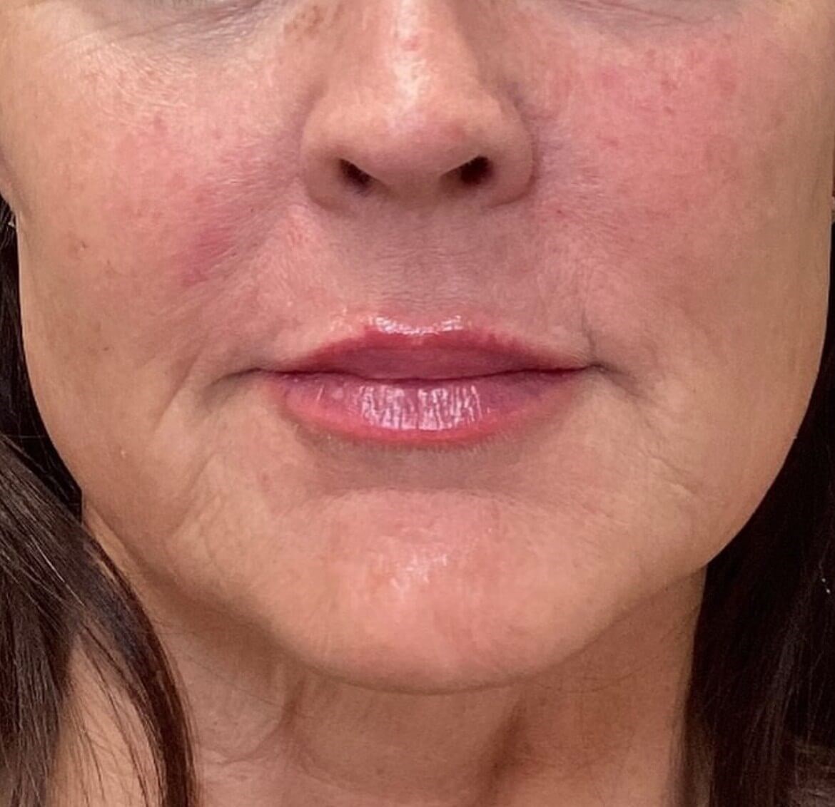 Comprehensive Skin Plan After