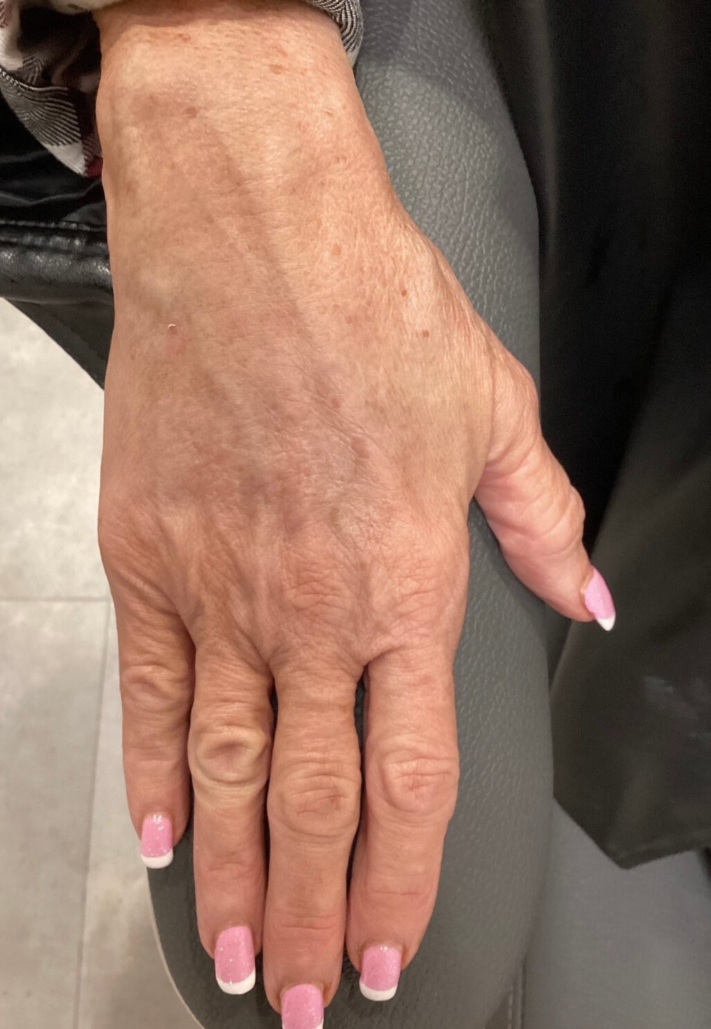 Instant Volume Restoration After