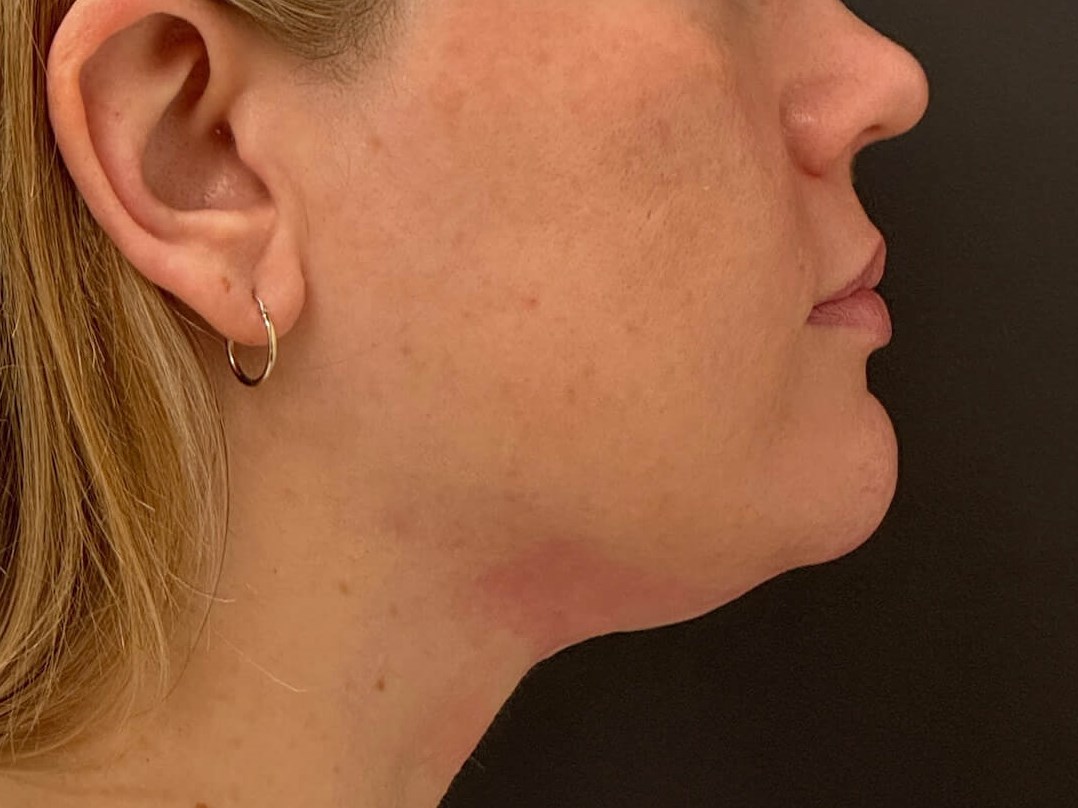 Before Image