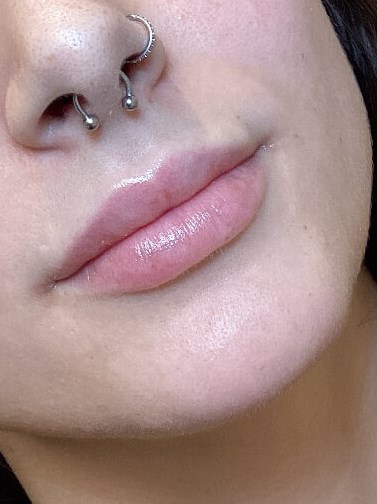 Enhacing your lips After