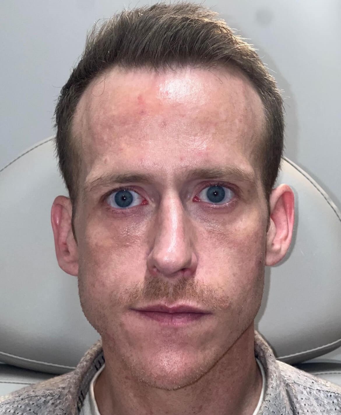 Before Image