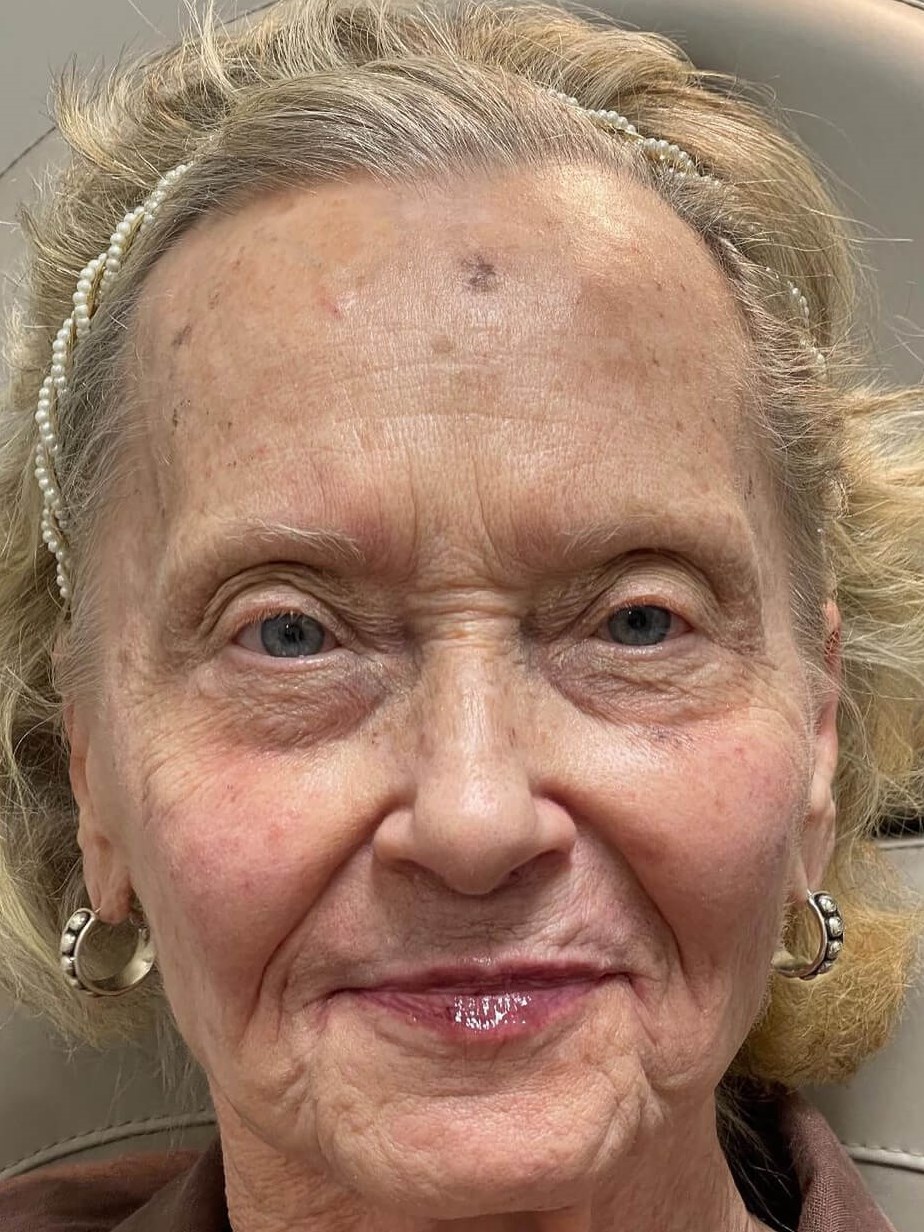 Rejuvenation for Mature Skin After