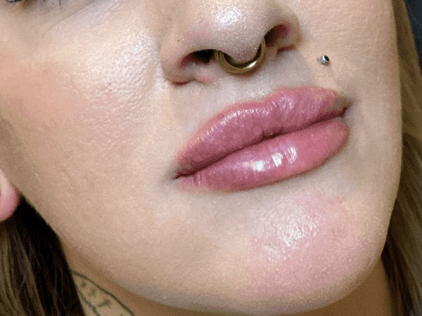 Fuller Lips at JEM After