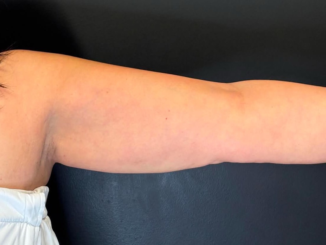 Contour and Tone Your Arms After