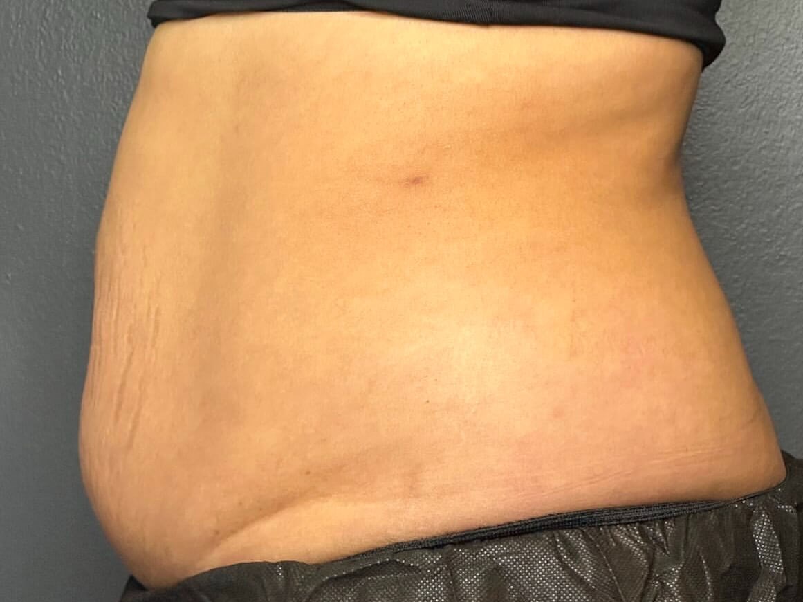Before Image