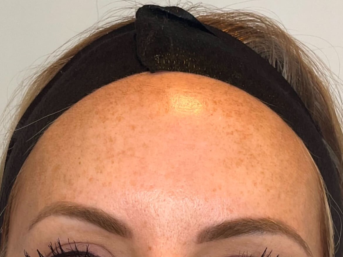 Before Image