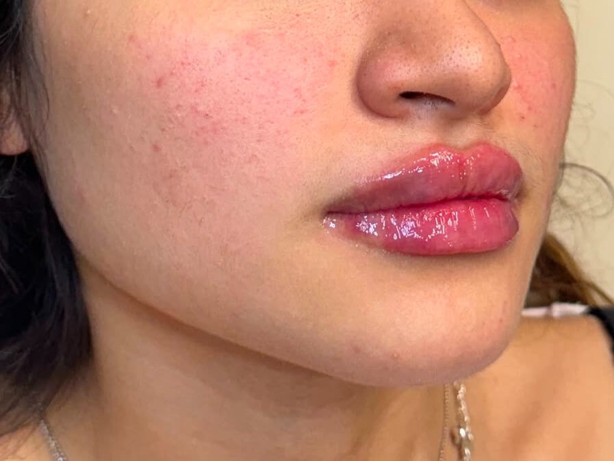 Enhance your Pout After