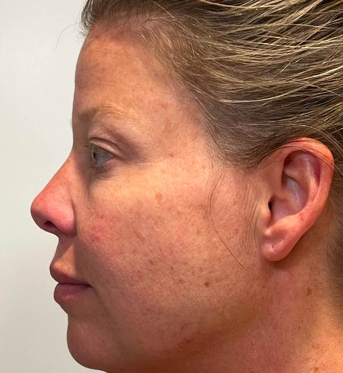Rejuvenate & Refresh Your Skin Before